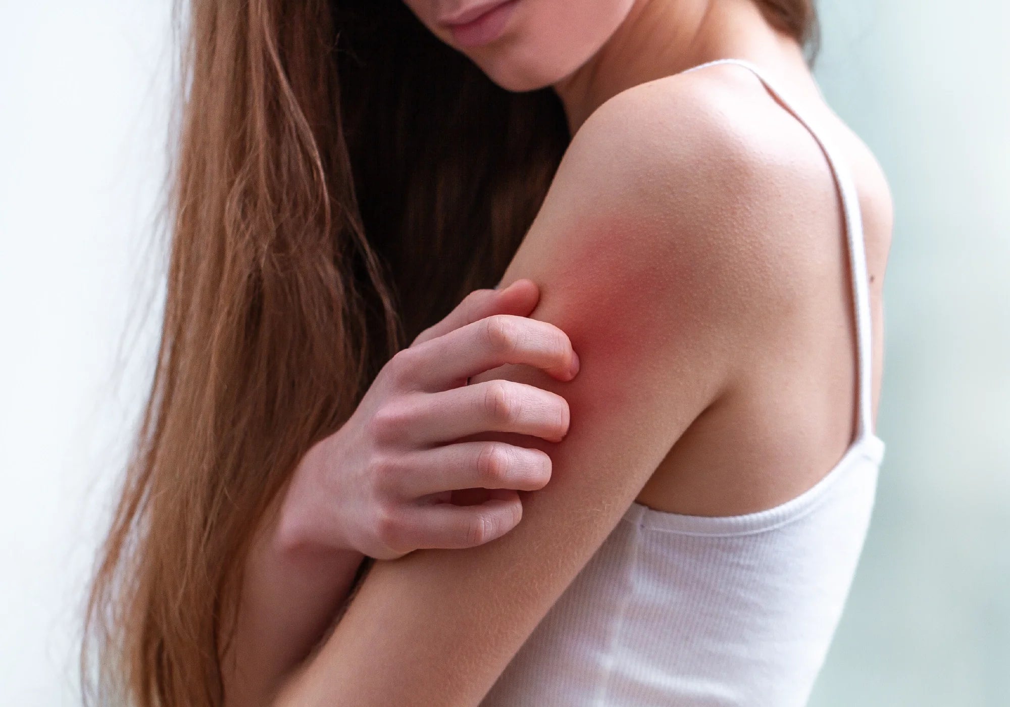 Как да си направите домашен лек против сърбеж